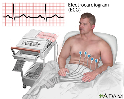 ECG Test